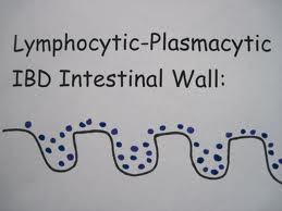 IBD Intestinal Wall