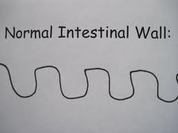 Normal Intestinal Wall
