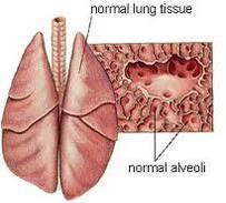 Lungs